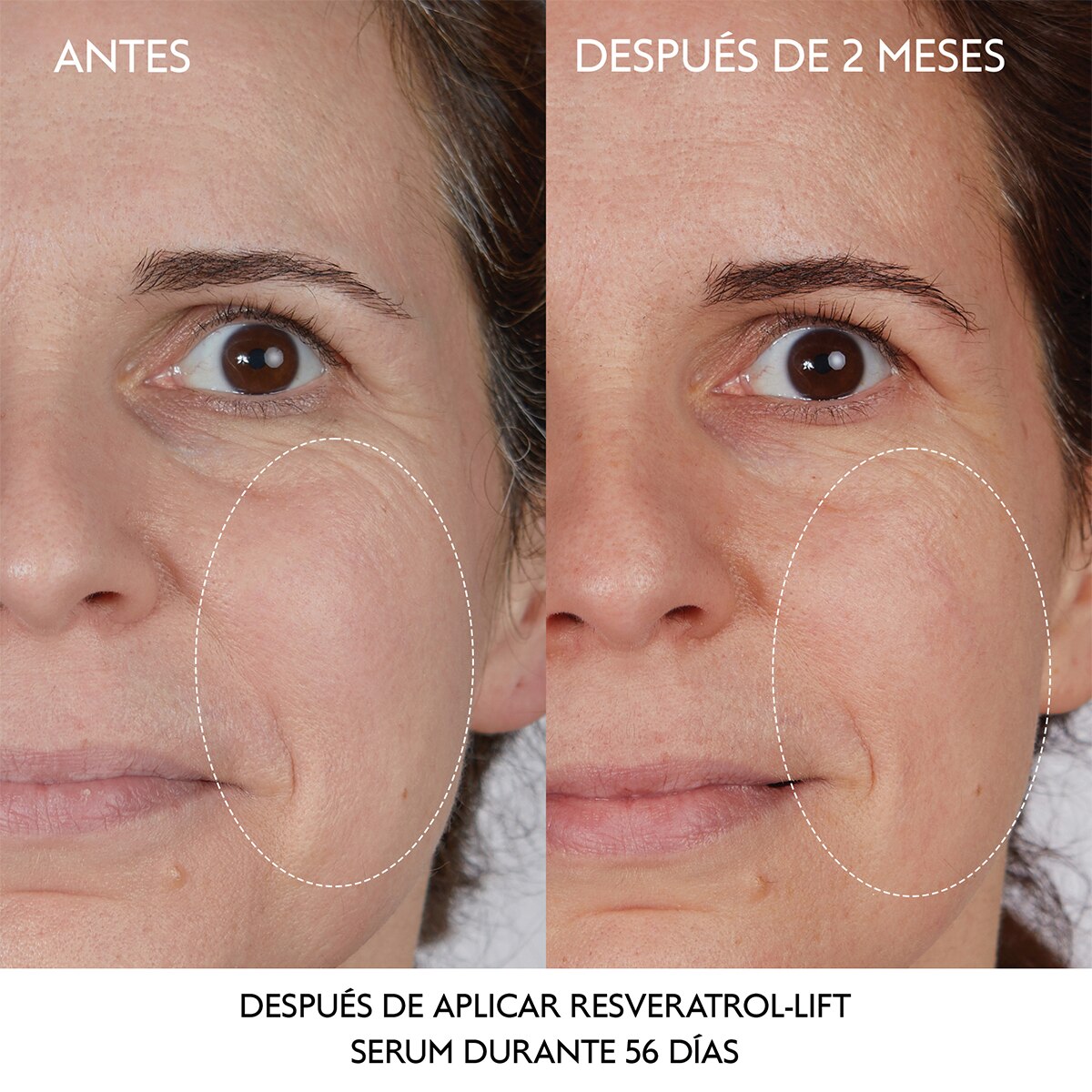 RESVERATROL-LIFT S&Eacute;RUM REAFIRMANTE INSTANT&Aacute;NEO